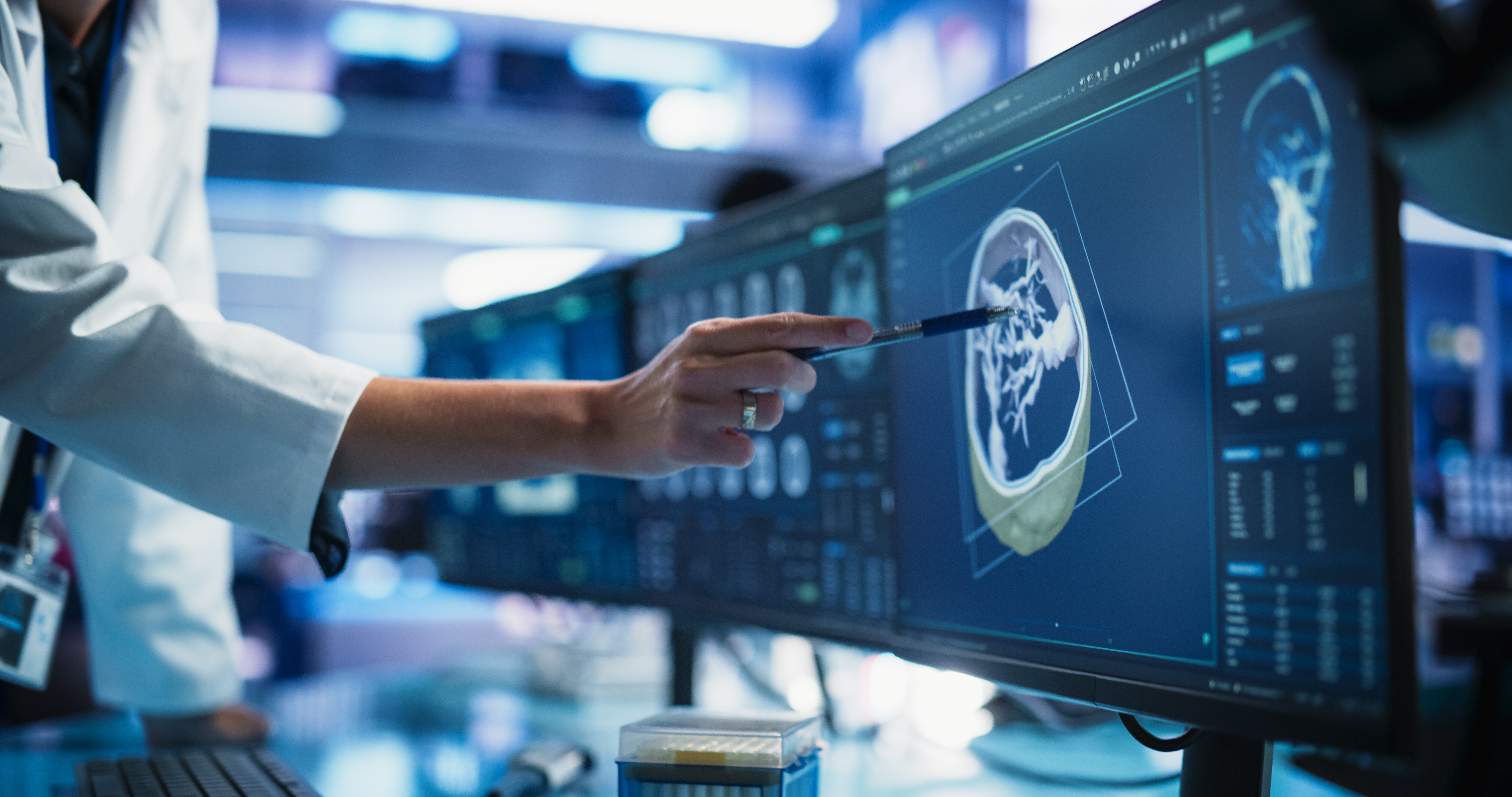 Médico analisa exame de imagem em monitor durante avaliação de paciente com suspeita de câncer