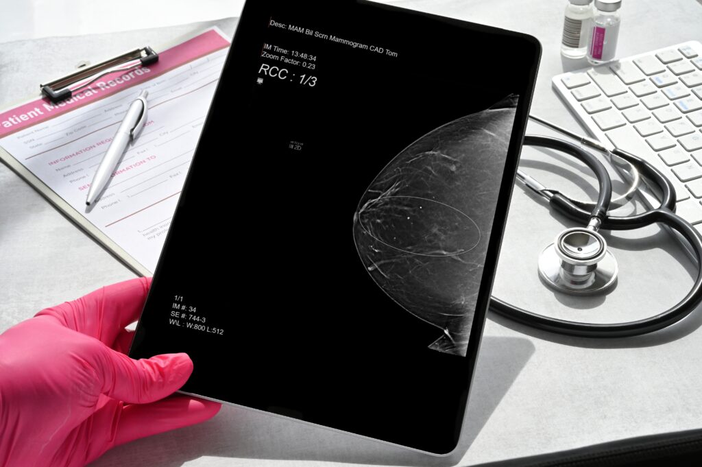 Imagem mostra exame de mamografia em exibição digital durante avaliação médica